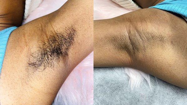 Waxing Before & After