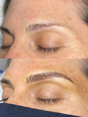 Before/After Microblading