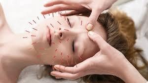 Chelsea Acupuncture