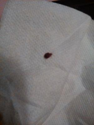 One of millions of bed bugs