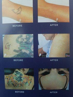 Dr Ink Eraser