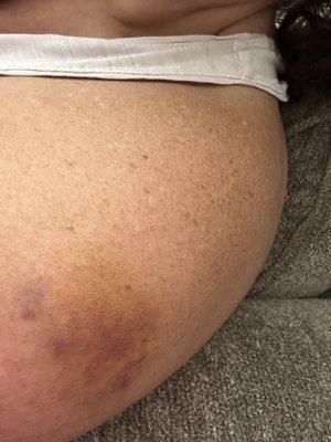 Live Hydration Spa Horsham