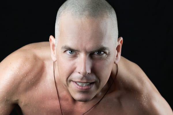 Scalp Micropigmentation Hair Loss Clinic treating balding, thinning, receding hair line, bald spot, transplant scars and Alopecia