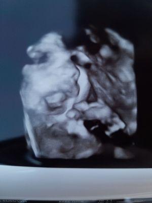 Baby Boy Yawn, 30 weeks