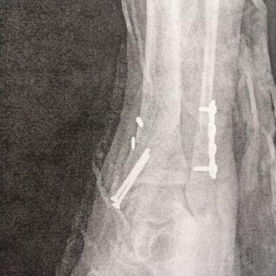 Western Washington Foot & Ankle Specialists