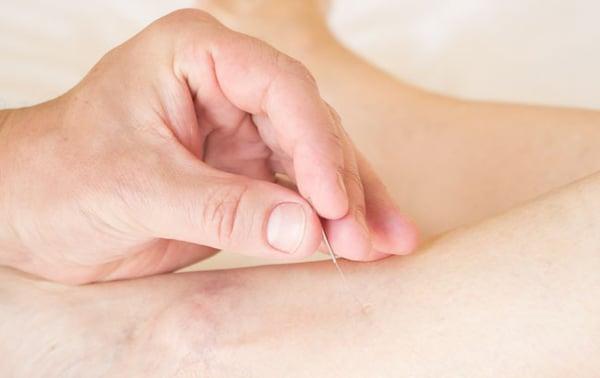 Matt Anderson Acupuncture