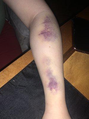 Harrison Hospital Silverdale