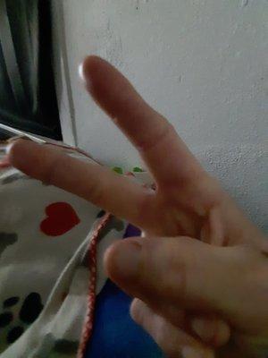 Oakland Physical Therapy & Hand Rehabilitation