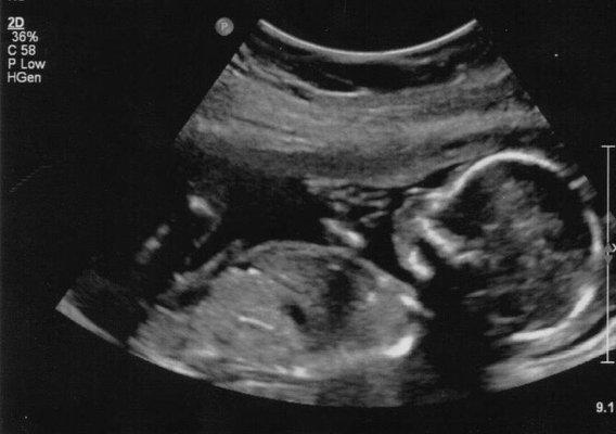 Creative Ultrasound Imaging