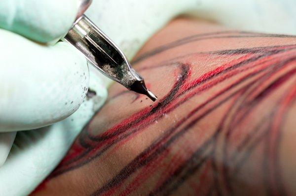 If you search for a professional tattoo removal service, this is the right place! Feel free to contact us for more information!