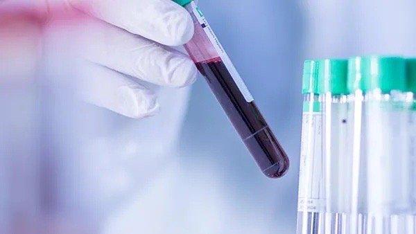 UTSW Hospital Outpatient Laboratory