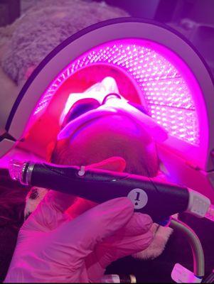 Hydrafacial Signature & lightstim led therapy
Treats
-sun damage
-fine lines & wrinkles
-clogged pores
