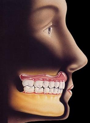 Tacoma Denture Clinic
