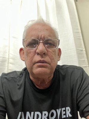 Frank Federal Bonding