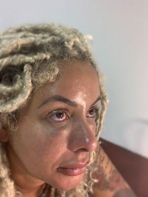 Aesthetic Enhancement