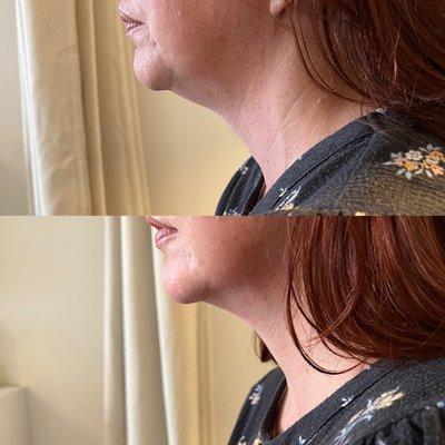 Beauty and Bella Body Contouring