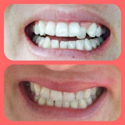 Dr. Ericks is an awesome dentist! He turned my smile into perfection in my eyes! very pleased with the outcome!