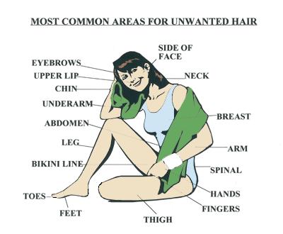 Most Common Areas for Unwanted Hair in Women