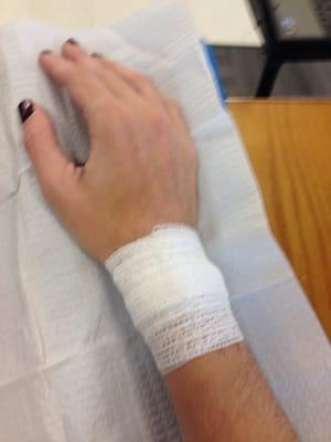 After wrist surgery.