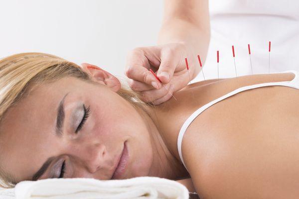 Hair fine sterile needles are placed in points along meridians.