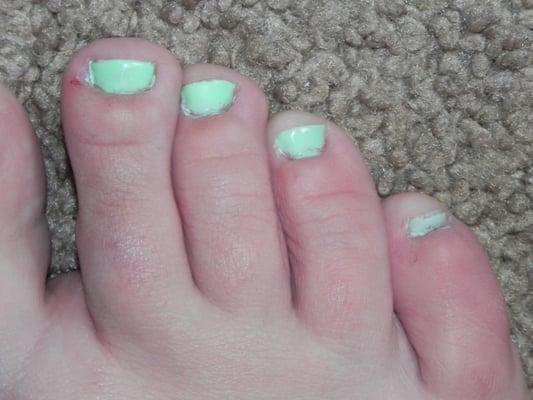 Awful pedicure