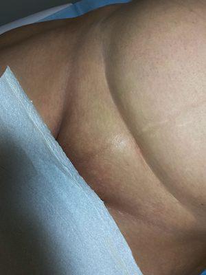 Brazilian Wax