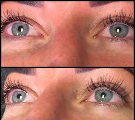 Both are after photos - two different angles