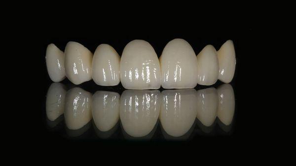 At Sherman Dental Lab, we provide services from single-unit dental crowns, bridges, flexible, and full or partial dentures.