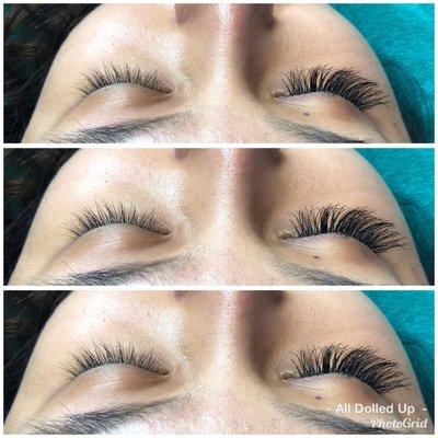 Before & After Classic Set