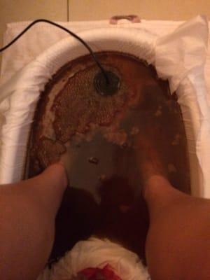 Detox foot bath.