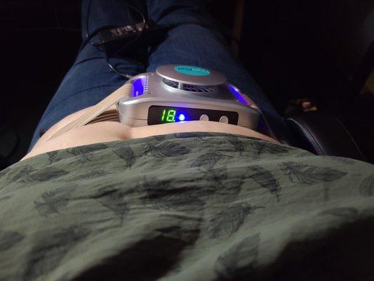 Coolsculpting And Facials With Dee