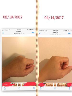 曬傷、新舊斑淡化、嫰膚⋯