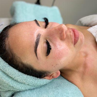 European facial / post facial glow