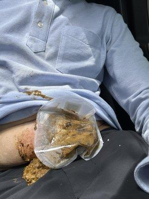 Oops... happening right now. ...another break in the sealed pouch. So perfect ....