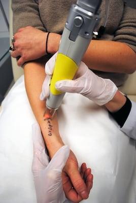 Abilene Tattoo Removal Clinic