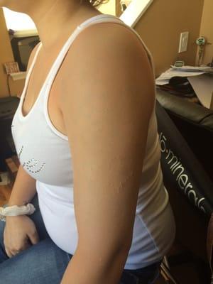 Tattoo coverup after