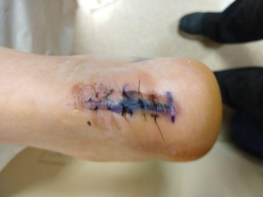 Scaccia Physical Therapy & Sports Conditioning