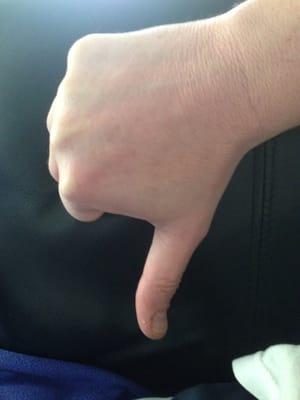 Fitzgibbons is a crook