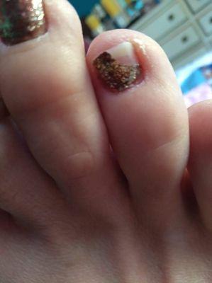 8 days. Notice the uncured cuticle