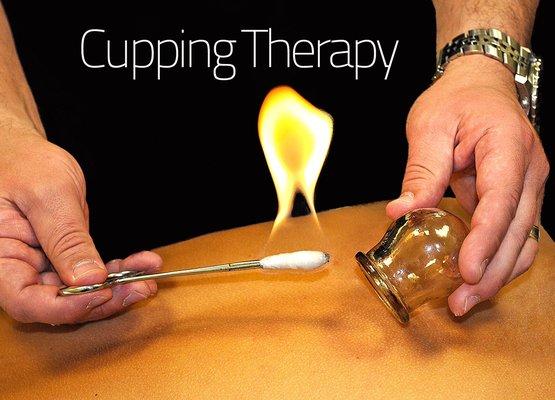 We offer a detail 360 point Health Analysis, Dry Cupping, Cupping Massage, Hijamah Therapy and Deep Tissue Massage.