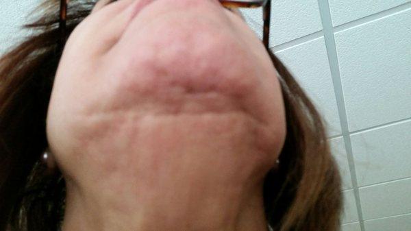 Americas Vein Centers