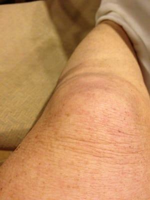 Lakeland Rehabilitation Services