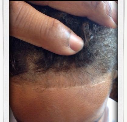 This guy cut my sons forehead.. And it's turning into a scar :( .. I will never go back!