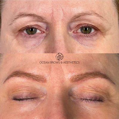 Microblading
