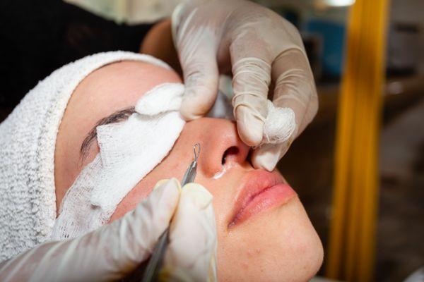 Definitely have to start at young age when you are more acne prone.