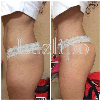 Lose inches with every visit!