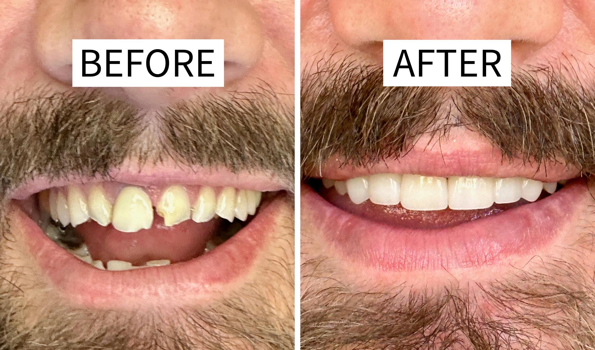 Advanced Dental Care - Mike Clark D.D.S. and Derek Tew D.D.S