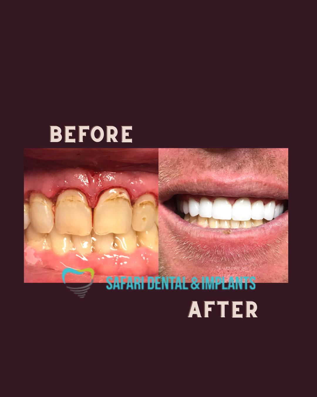 Safari Dentistry & Implants