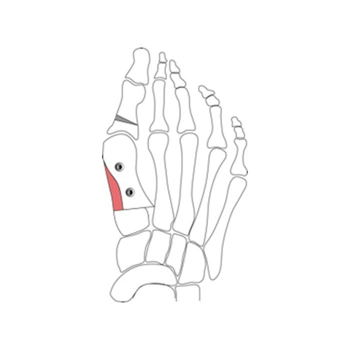 Michael O'Neill - Fix My Foot