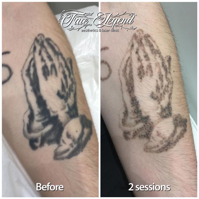 True Legend Aesthetics & Laser Clinic